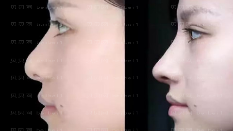 兰州爱美相伴整形医院怎么样?医生排名