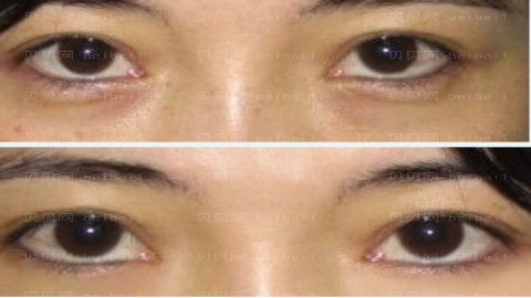 兰州华夏整形医院怎么样？医生团队+整形价格