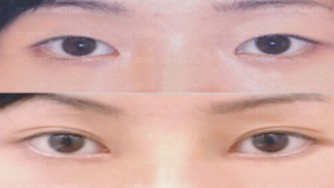 兰州仁和整形医院怎么样?医生团队+整形价格