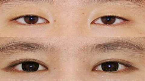 兰州圣莫丽斯整形医院怎么样?医生排名