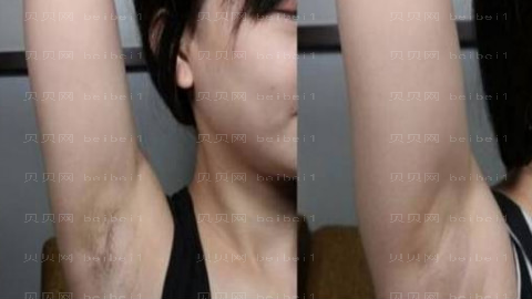南昌爱思特整形医院怎么样?医生团队+整形价格