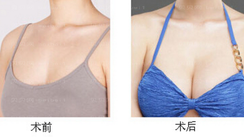 上海欧莱美整形医院怎么样？医生团队+整形价格