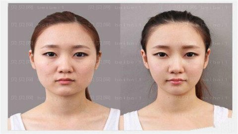 上海健丽整形医院怎么样?医生团队+整形价格