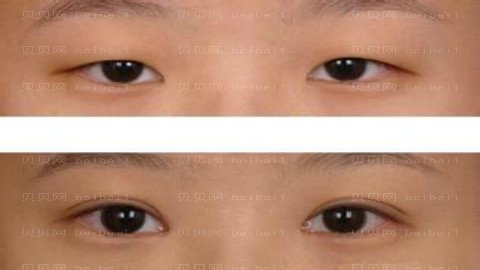 上海南山医院整形怎么样？医生团队+整形价格
