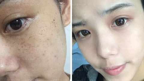 威海福神整形医院怎么样?医生团队+整形价格