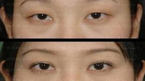 淄博壹美整形医院怎么样?医生团队+整形价格