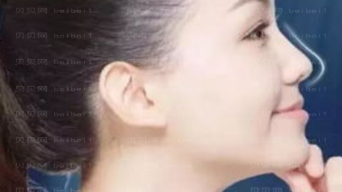 上海做下颌角厉害的医生哪个好?上海下颌角手术医生排名名单
