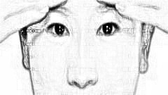 郭万厚去眼袋怎么样?郭万厚去眼袋介绍及