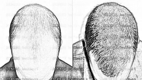青岛洋美植发怎么样?哪个医生技术好