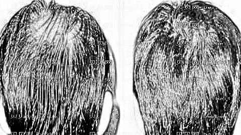厦门新生植发怎么样?医生排名名单