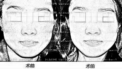 深圳医美汇整形技术怎么样?医生介绍