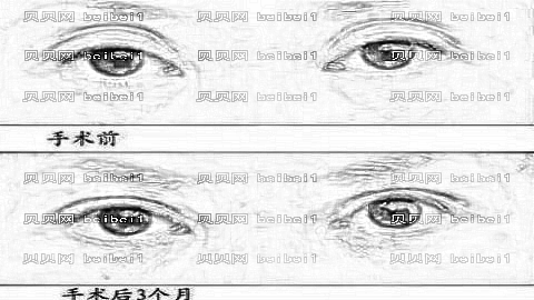 广州古汀整形医院靠谱吗?,整形价格一览表!医生介绍名单