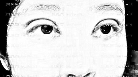 成都李烈院长做眼睛怎么样?成都李烈院长做眼睛手术介绍及