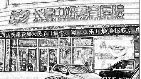中研开眼角做双眼皮怎么样?中研开眼角做双眼皮介绍及