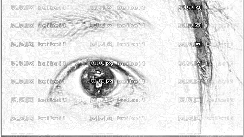临沂瑞丽开眼角怎么样?临沂瑞丽微创开眼角介绍及