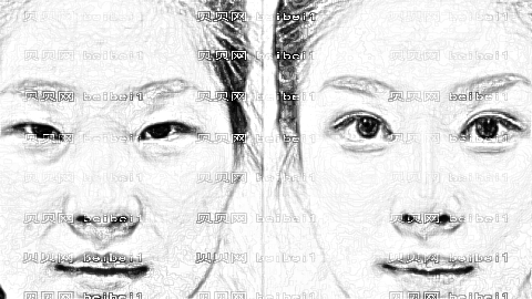 常州李新庆医生去眼袋怎么样?去眼袋手术介绍及