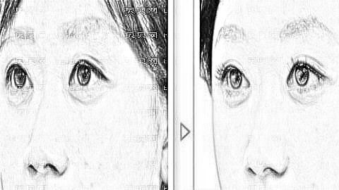 汕头爱丽诺整形医院靠谱吗？医生团队+整形价格