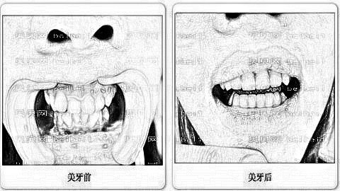 广州德伦口腔医院怎么样?较新价格一览表!医生介绍名单
