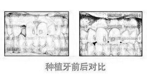 中山香山口腔口碑怎么样?,正畸价格一览表!医生排名名单