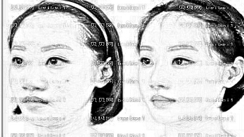 长沙半岛整形医院怎么样?哪个医生隆鼻技术好?附,版