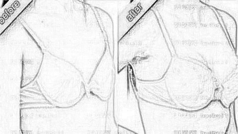 桂林时光,整形,桂林时光隆胸医生+介绍,告别飞机场