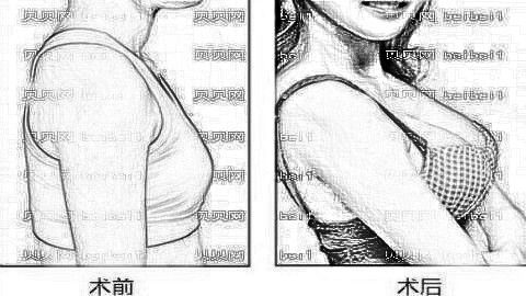 广州博仕整形医院靠谱吗?内部整形价格一览表!医生介绍名单