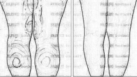 柳州医美整形口碑怎么样?柳州医美吸脂多少钱?哪个医生技术好