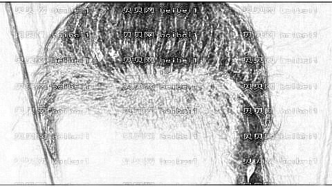 南宁贞韩植发医院靠谱吗?哪个医生发际线植发做得好?附