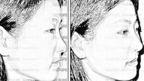 上海九院整形技术怎么样?医生团队+整形价格