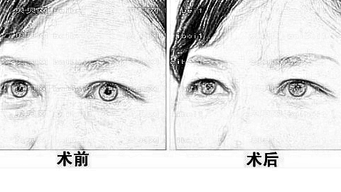 上海臻禾整形医院怎么样?医生团队+整形价格
