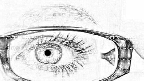 埋线双眼皮手术的原理是什么？埋线双眼皮恢复期注意事项有哪些？
