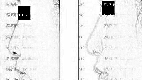岳阳爱思特隆鼻多少钱？岳阳爱思特医生介绍+全新整形