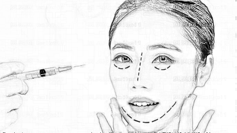 长沙南湖自体脂肪填充多少钱?哪个医生技术?附介绍
