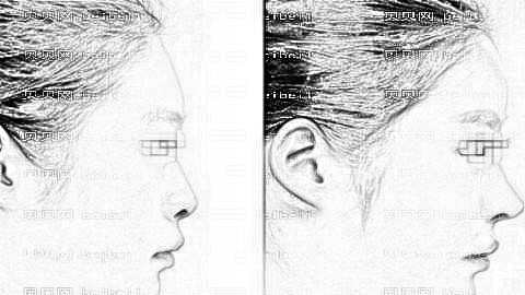 常州曙光隆鼻多少钱?附常州曙光隆鼻医生介绍+整形