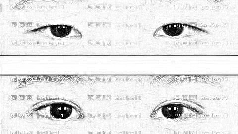 贵阳美和谐整形医院靠谱吗?贵阳美和谐双眼皮多少钱?附