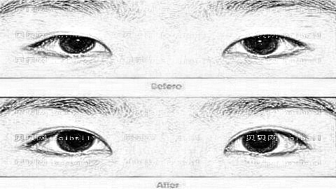 美之峰刘磊医生双眼皮做的好吗？刘磊双眼皮价格一览表+介绍