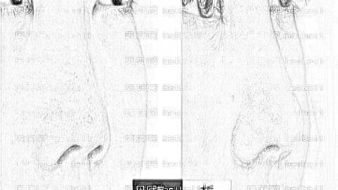 长沙隆鼻医生攻略|长沙协雅肖琦医生隆鼻怎么样?附+介绍