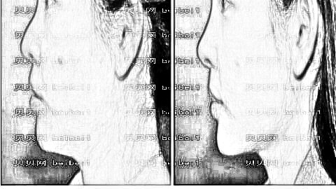美之峰丁翔医生做鼻部手术怎么样?丁翔隆鼻价格一览表,附介绍