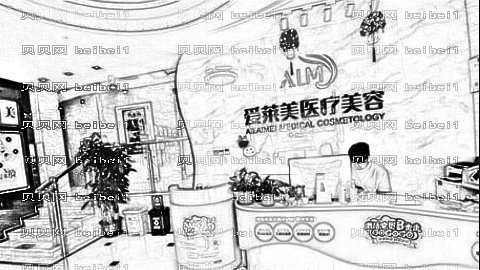 北京美莱做眼睛怎么样?北京美莱做眼睛手术介绍,术后很好看!