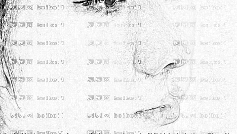 隆鼻手术恢复期多久?隆鼻手术不满意怎么办?