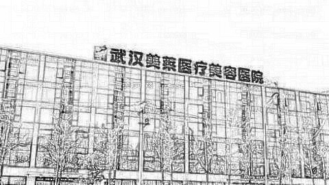 武汉美莱做眼睛怎么样?武汉美莱做眼睛介绍,气质提高!