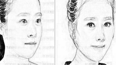 株洲宇芳姬隆鼻多少钱?株洲宇芳姬医生介绍+全新整形