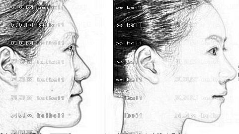 南京医科大学友谊整形医院鼻部手术多少钱?附全新+介绍