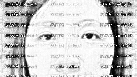 假体隆鼻多久可以完全固定?假体隆鼻几天可以固定不晃动?