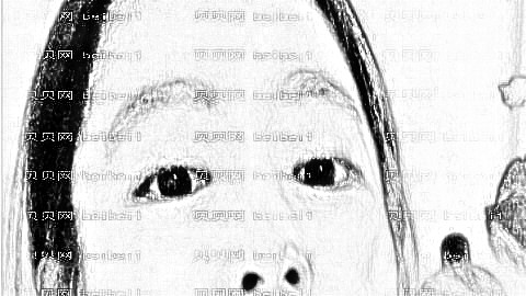 假体隆鼻可以侧身睡觉吗?假体隆鼻后多久可以侧着睡?