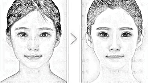 邹俊峰做鼻子技术好吗?长沙美莱邹俊峰隆鼻价格一览表及介绍