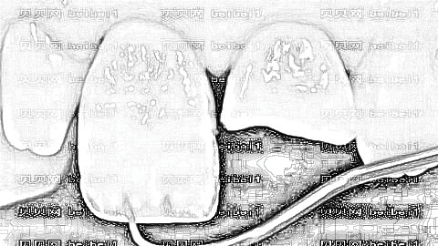 南京博韵口腔医院靠谱吗？南京博韵口腔种植牙多少钱？附介绍