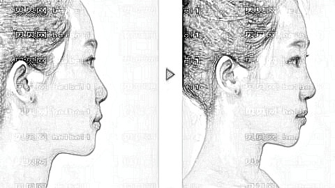 南京美莱自体脂肪面部填充多少钱?哪个医生技术?附介绍