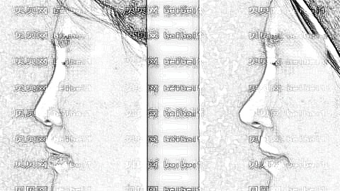 南京华美隆鼻多少钱?附南京华美隆鼻医生介绍+整形