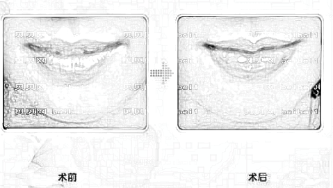 大连爱德丽格整形美容医院靠谱吗?内附电话地址+,